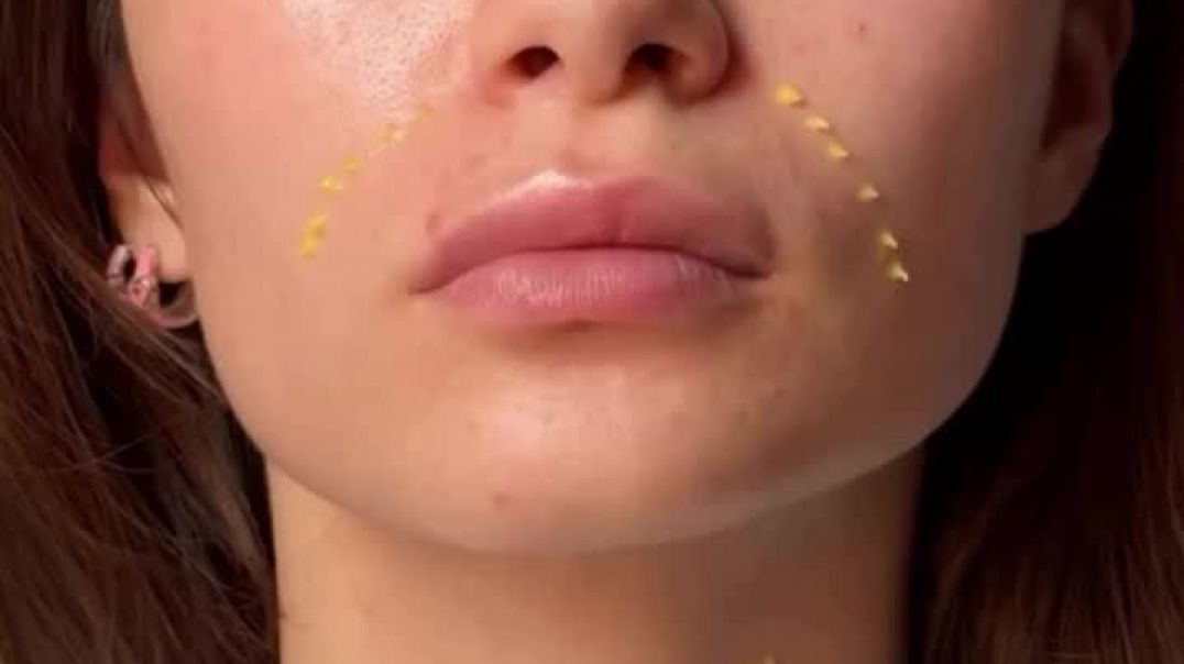 Retinol kremi